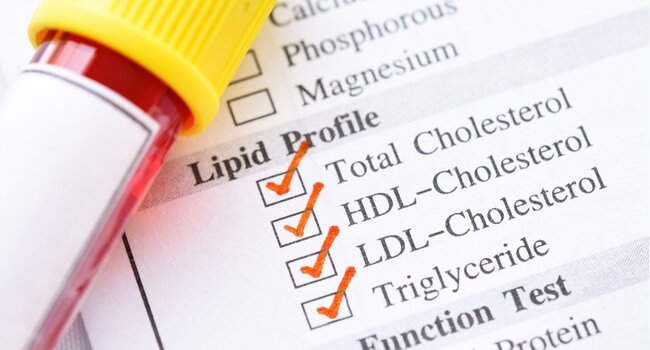 lipid-profile-test-to-assess-cardiovascular-health-by-measuring-total-cholesterol-hdl-ldl-and-triglycerides