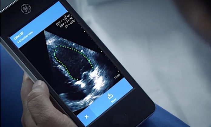 GE brings in AI-powered software to cardiac ultrasound device