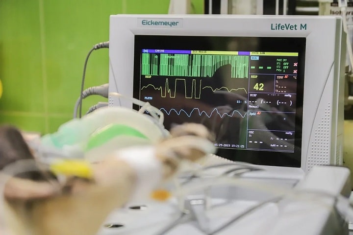 What is Patient Monitors & How does a patient monitor Work